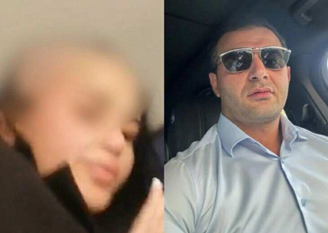 Arvadının saçını keçəl edən ərə – Hökm oxundu